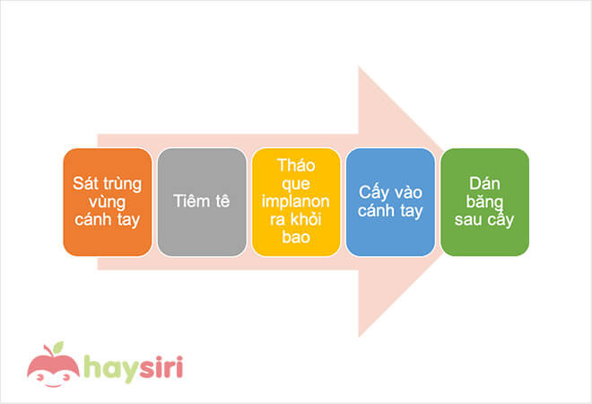 5 bước cấy que tránh thai