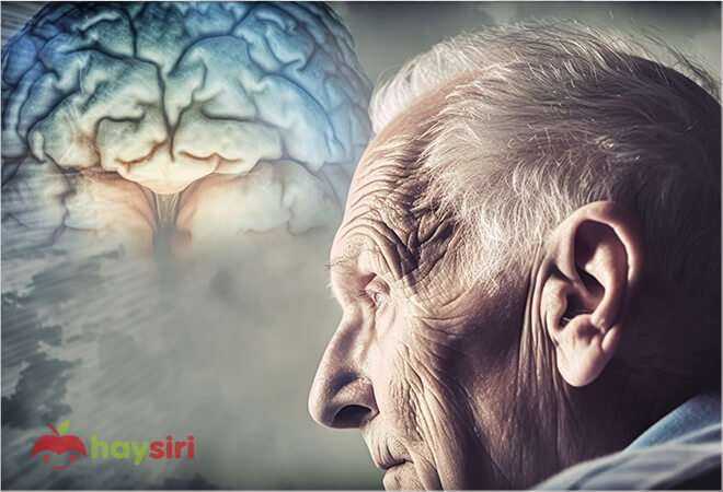 bệnh alzheimer là bệnh gì