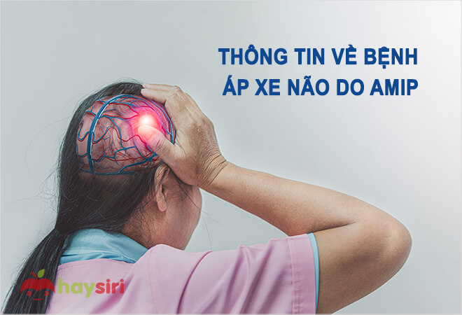 bệnh áp xe não do amip là gì