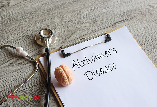 Phương pháp chuẩn đoán bệnh alzheimer