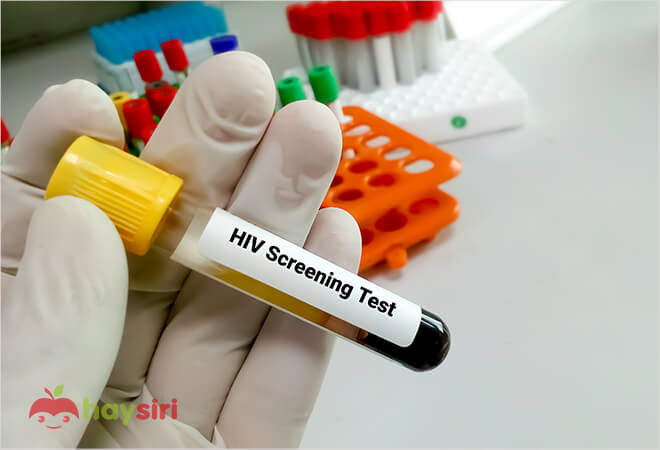 xét nghiệm máu chuẩn đoán bệnh hiv