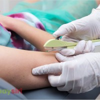Review cấy que tránh thai - Trải nghiệm, giá cả và tác dụng phụ (Update 2023)