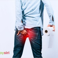 Hiểu rõ hơn về Bệnh áp xe hậu môn là gì để có phương pháp điều trị hiệu quả