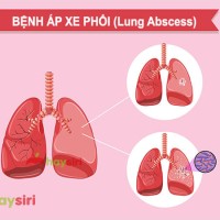 Tìm hiểu về bệnh áp xe phổi, Bệnh cần điều trị sớm tránh tiến triển đến biến chứng nguy hiểm.