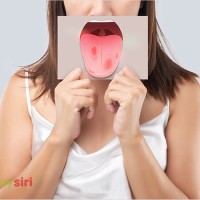 Bạch sản niêm mạc miệng: Hiểu rõ nguyên nhân, triệu chứng và cách điều trị!