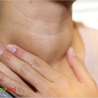 Có thể chữa khỏi Basedow? Tìm hiểu về tiến bộ trong điều trị bệnh basedow