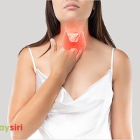 Bệnh Basedow: Khám phá về căn bệnh nổi tiếng gây ảnh hưởng đến hệ thần kinh và nội tiết