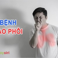 Khám phá bệnh lao phổi: Tìm hiểu về căn bệnh cổ xưa gây sốt trong thế kỷ 21