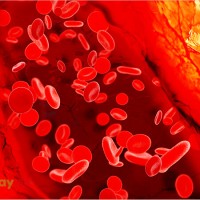 Bệnh bạch cầu cấp (ung thư máu): Hiểu rõ về Nguyên Nhân, Triệu Chứng và cách điều trị