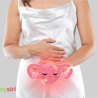 Bệnh đa nang buồng trứng có tự khỏi không? Cách chữa đa nang buồng chứng tại nhà