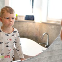 Kiêng gió và kiêng nước trong điều trị bệnh sởi: Đúng hay sai?