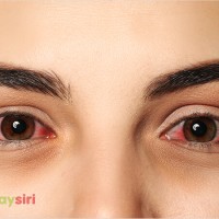 Giải đáp: Nhìn vào mắt người bị đau mắt đỏ có bị lây không?