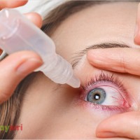 Các loại thuốc nhỏ được sử dụng hiệu quả trong điều trị đau mắt đỏ