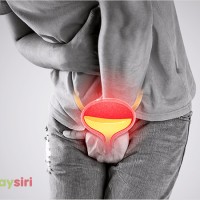 Bàng quang tăng hoạt: Khám phá nguyên nhân và cách chữa trị vấn đề khó chịu này