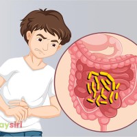Tìm hiểu về bệnh kiết lỵ: Nguyên nhân, triệu chứng và cách điều trị hiệu quả