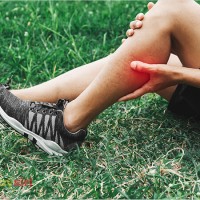 Căng cơ bắp chân là gì? Nguyên nhân đằng sau và bí quyết điều trị hiệu quả!