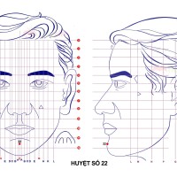 Huyệt số 22 diện chẩn