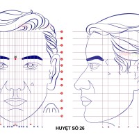 Huyệt số 26 diện chẩn
