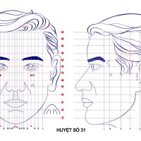 Huyệt số 31 diện chẩn