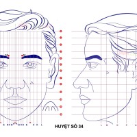 Huyệt số 34 diện chẩn