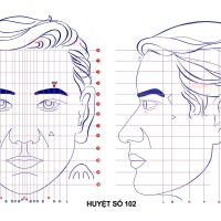 Huyệt số 102 diện chẩn