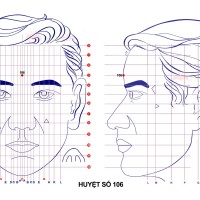 Huyệt số 106 diện chẩn