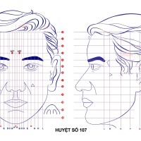 Huyệt số 107 diện chẩn