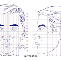 Huyệt số 71 diện chẩn