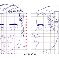 Huyệt số 91 diện chẩn