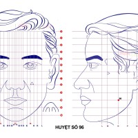 Huyệt số 96 diện chẩn