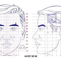 Huyệt số 98 diện chẩn