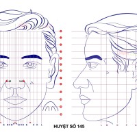 Huyệt số 145 diện chẩn