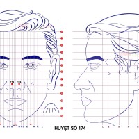 Huyệt số 174 diện chẩn