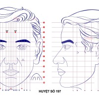 Huyệt số 197 diện chẩn điều khiển liệu pháp