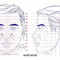 Huyệt số 243 diện chẩn