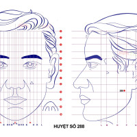 Huyệt số 288 diện chẩn