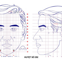 Huyệt số 292 diện chẩn