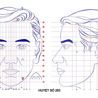 Huyệt số 293 diện chẩn