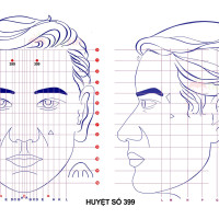 Huyệt số 399 diện chẩn