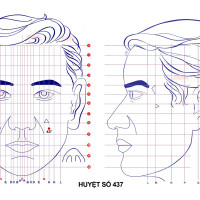 Huyệt số 437 diện chẩn