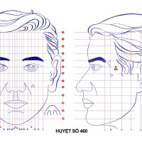 Huyệt số 460 diện chẩn