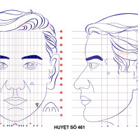 Huyệt số 461 diện chẩn