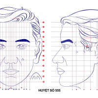 Huyệt số 555 diện chẩn