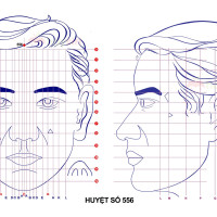 Huyệt số 556 diện chẩn