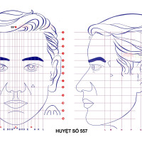 Huyệt số 557 diện chẩn