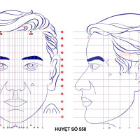 Huyệt số 558 diện chẩn