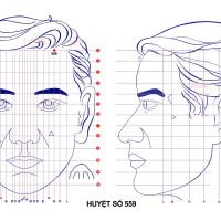 Huyệt số 559 diện chẩn