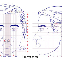 Huyệt số 630 diện chẩn